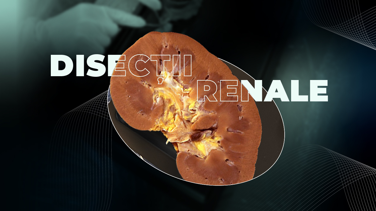 Workshop Oradea: Disecții Chirurgicale Renale