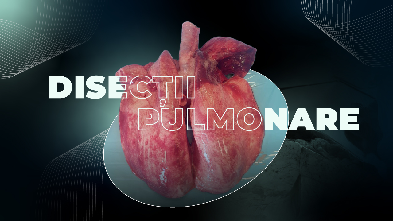 Workshop Oradea: Disecții Pulmonare