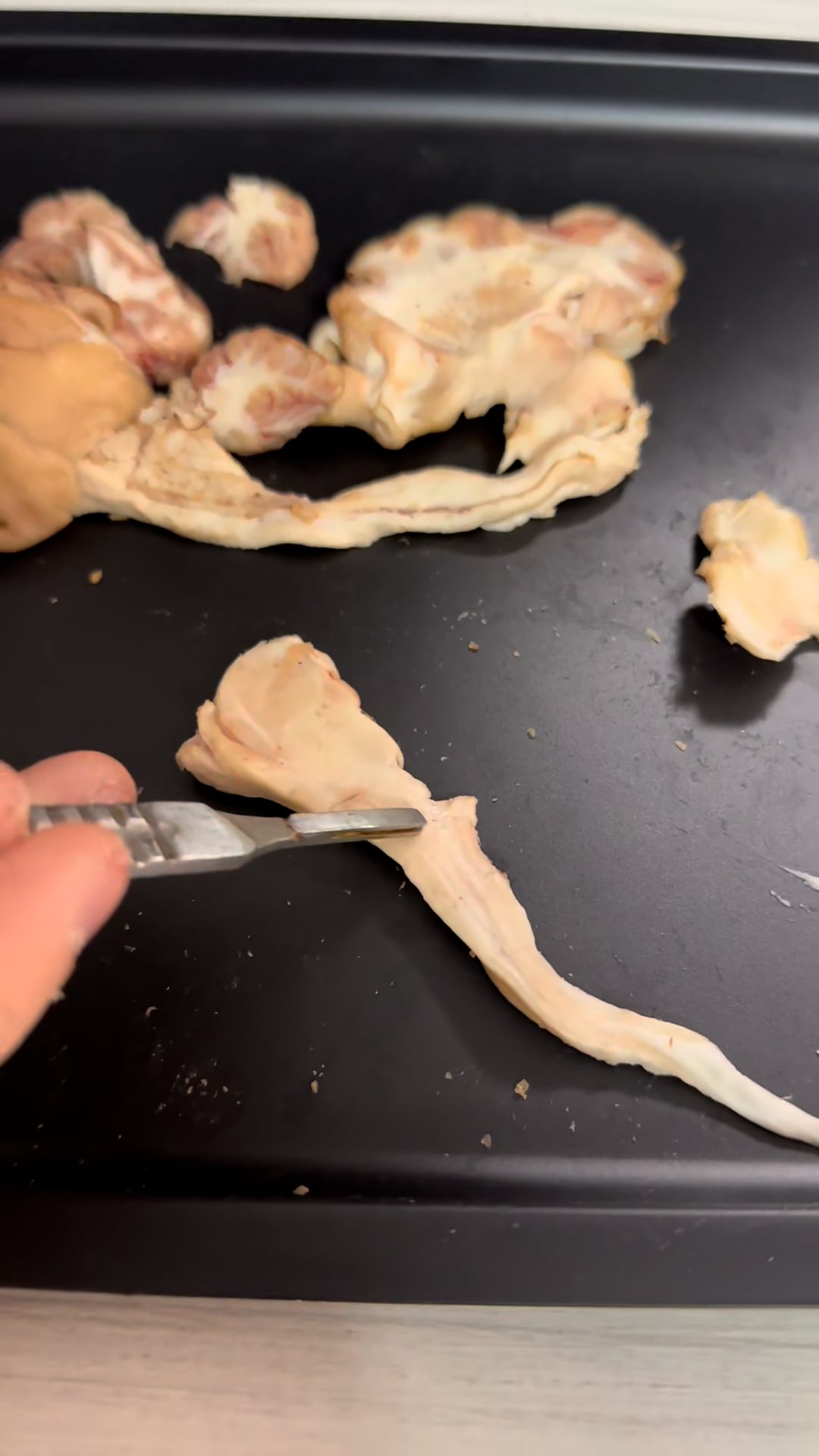 Disecție Cerebrală