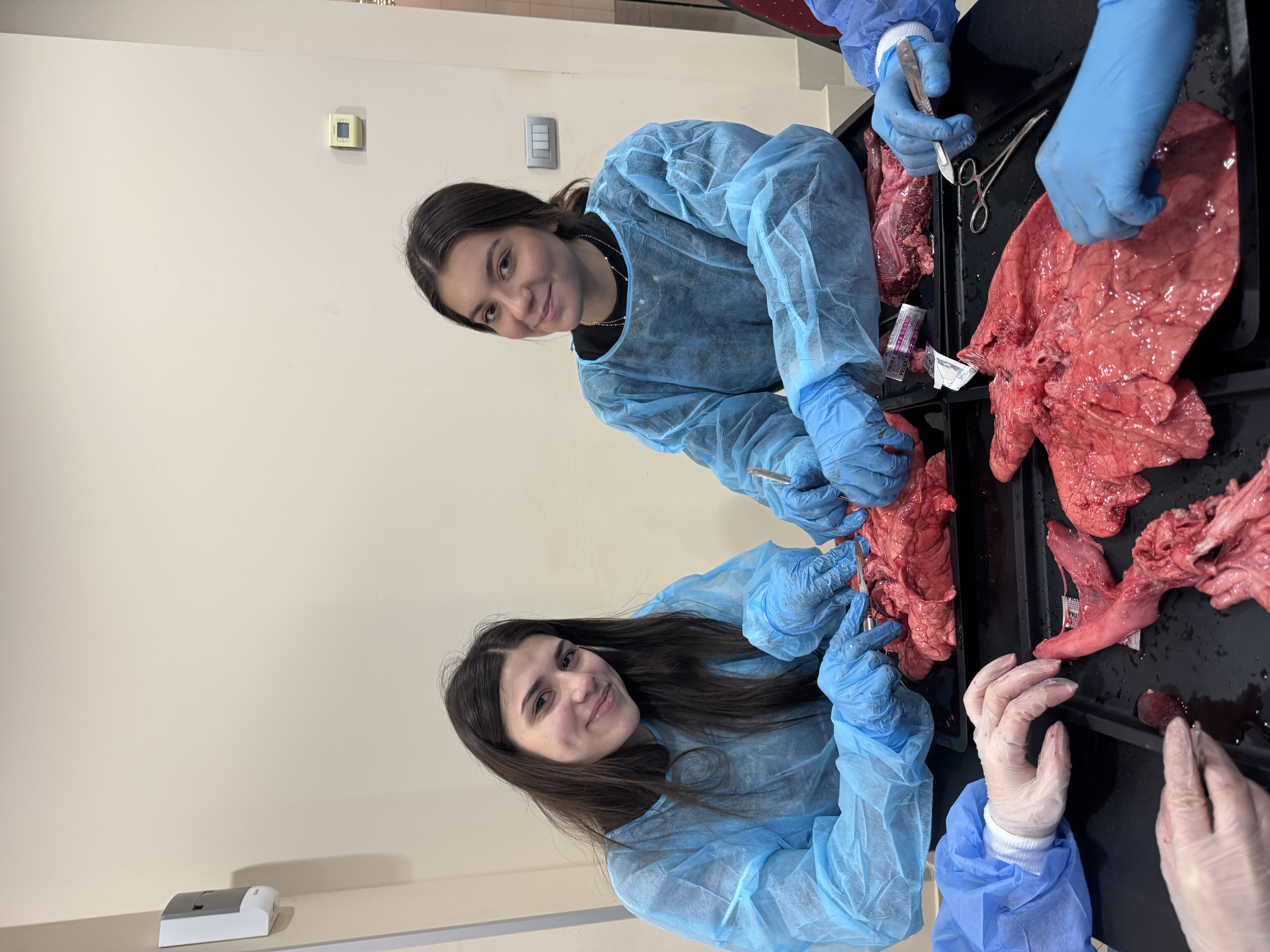 Disecție Pulmonară